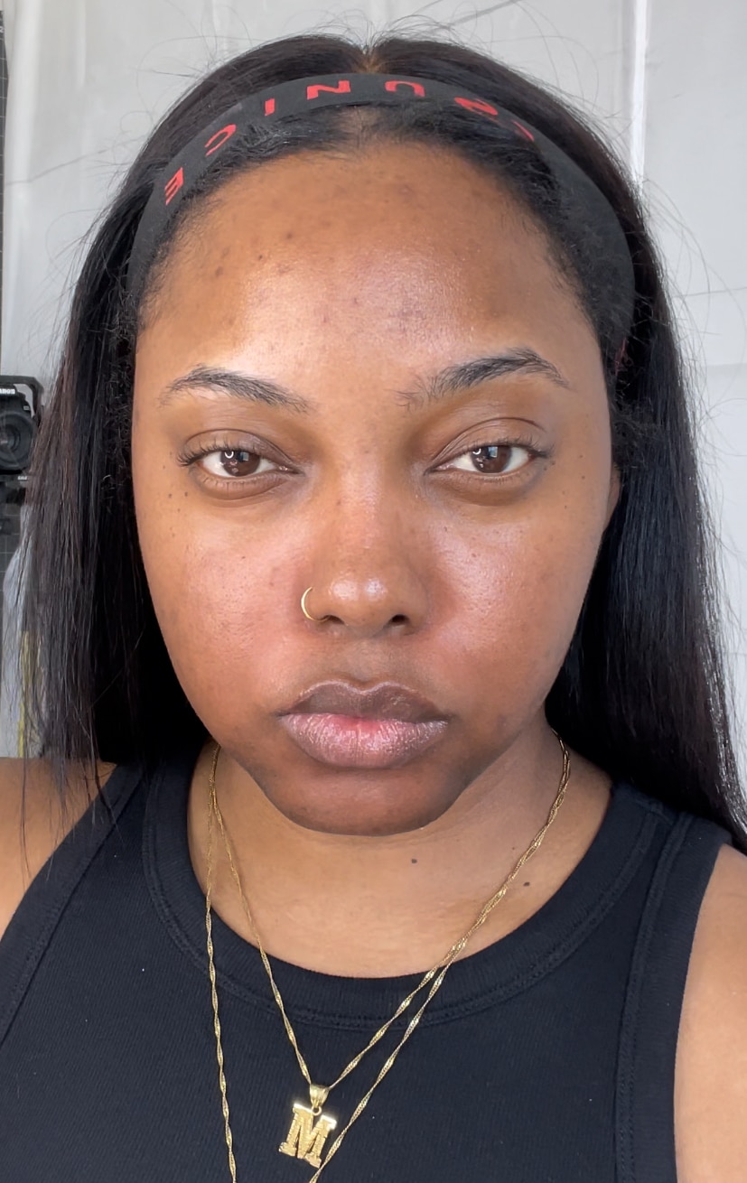 skincare products to fade hyperpigmentation