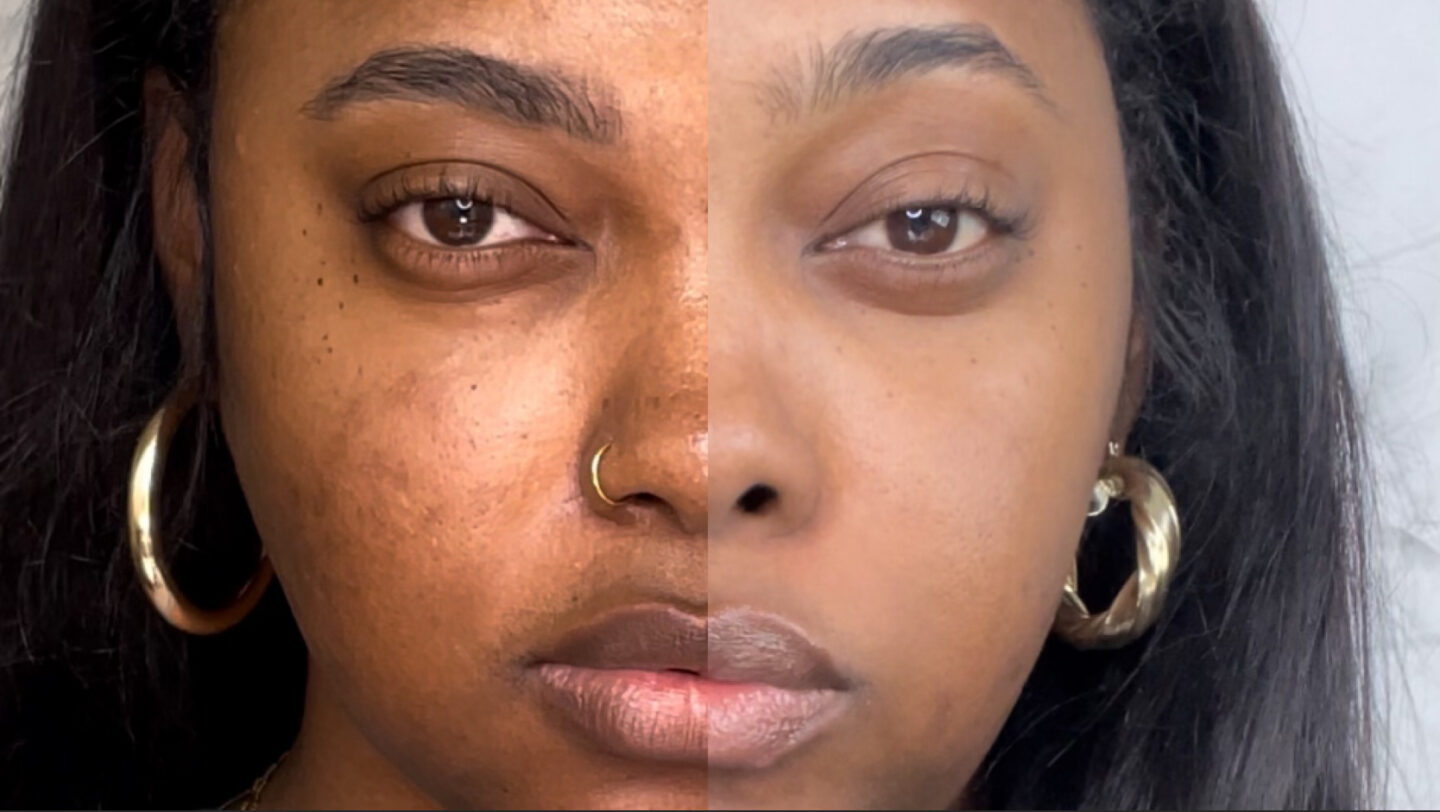 Split image showing skin barrier repair progress on melanin-rich dark skin — texture and hyperpigmentation improvement